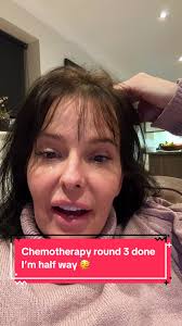 Barbara Head and Neck Cancer