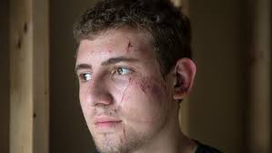 Police reports offer more details in February 'naked man' shooting