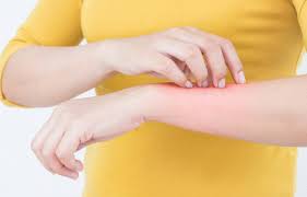 Le temps d'exposition au soleil doit être d'autant plus court que la peau du sujet est claire, qu'il est jeune et que l'indice uv est fort. Allergie Au Soleil Comment Soigner Boutons Plaques Rougeurs Dus A L Exposition Au Soleil Tout Pratique