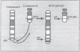 Cromosoma Philadelphia, fusión BCR/ABL. Tomada con autorización del...