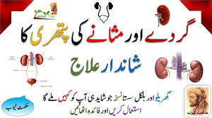 Health Care For Kidney Stones Treatment Bladder Stones Treatment Kidney Youtube