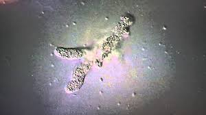 Amoeba (plural amoebas/amoebae) is a genus that belongs to kingdom protozoa. Amoeba Under Microscope Video 1 Youtube