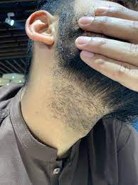 It is actually the most common method of removing unwanted hair. Can Waxing Beard Make Skin Go Black I Have Been Doing Wax Since 1 5 Years Visited New Barber And He Is Saying That Wax Made My Skin Black Why Is That I