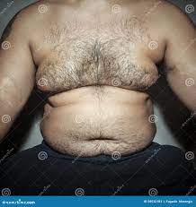 278 Fat Hairy Belly Stock Photos - Free & Royalty-Free Stock Photos from  Dreamstime