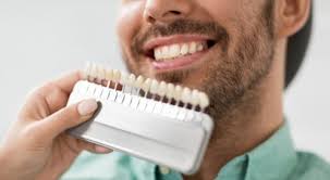 عدسات الأسنان اللاصقة فوائد وأضرار ويب طب