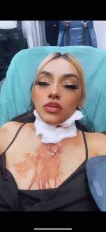 Fundraiser by Mary Roybal : Neck stab survivor