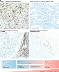 Confidence makes a difference if you are physically attractive or not. Approaches To Treat Immune Hot Altered And Cold Tumours With Combination Immunotherapies Nature Reviews Drug Discovery