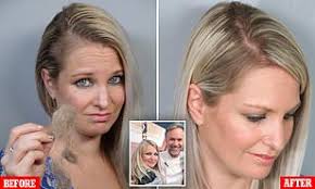 After he was born, these levels started to drop. Kimberley Coke Reveals Post Pregnancy Hair Loss Ruined Confidence Daily Mail Online