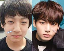 Official Idol Plastic Surgery Thread Allkpop Forums