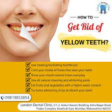 How To Get Rid Of Yellow Teeh Dental Cosmetics Yellow Teeth Stained Teeth