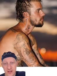 Did Justin Bieber have a hair transplant? #justinbieberhair #hairtran...