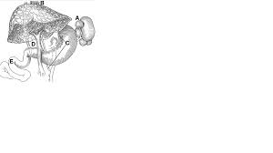 Because the bile is unable to drain, it builds up in the liver and damages the liver. Pishbvt2s0 Ocm