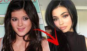 10 june 2020, 17:50 | updated: Kylie Jenner Plastic Surgery Before And After Express Co Uk