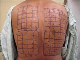 Image result for Patch Testing