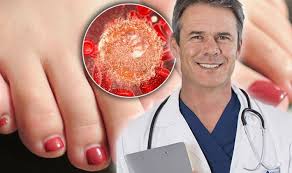 If you have any of these signs, see your doctor. Cancer Symptoms Signs Of Tumour On The Skin Include Toes Colour Changes Express Co Uk