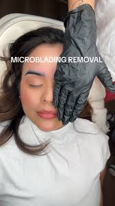Our next microblading removal pop up- September 13th ! Few spots left. Dm  to book