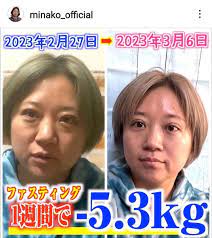 体重８２キロ超の美奈子、１週間で激やせ！ビフォーアフター「スッキリ」二重整形も話題 : スポーツ報知