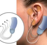 The Bridge Device For Opioid Withdrawal Symptoms - INSynergy
