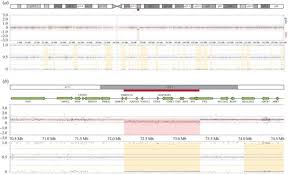 Set aside while you prepare the fish tacos. X Chromosome Inactivation In A Female Carrier Of A 1 28 Mb Deletion Encompassing The Human X Inactivation Centre Philosophical Transactions Of The Royal Society B Biological Sciences