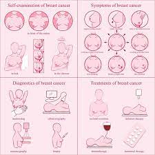 Inflammatory breast cancer progresses rapidly, often in a matter of weeks or months. Do You Know These Breast Cancer Symptoms Royal Coast Review
