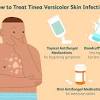 Ketoconazole is an antifungal medication that is effective against fungal or yeast infections. 1