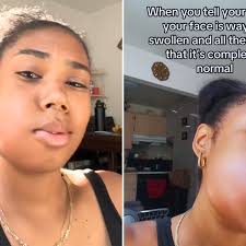 Internet Horrified by Woman's Shocking Reaction After Wisdom Teeth Removal 