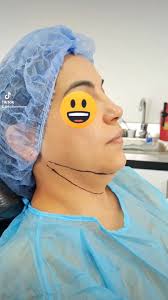 adios papada en solo 90 minutos...