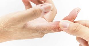 It hurts to bend or straighten. Sprained Finger Symptoms Treatment And Recovery