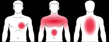 Give a differential diagnosis of retrosternal pain? Receive A Diagnosis For Chest Pain Cardiosecur