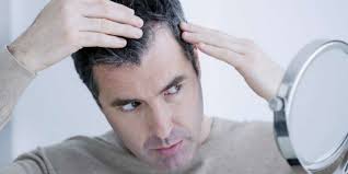 Some types of hair loss are permanent, like male and female pattern baldness. Stem Cell Hair Loss Treatments The Cure For Baldness Outsons Men S Fashion Tips And Style Guide For 2020