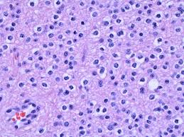 The histology of mesothelioma can provide insight to those who have been or have loved ones diagnosed with this cancer. 16 Histology Ideas Pathology Microscopic Photography Histology Slides