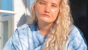 Tayla Clement e femeia care nu a zâmbit niciodată, deși are 24 de ani. Care  este motivul și cum îi afectează viața