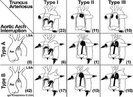 Truncus Arteriosus Thoracic Key