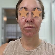 THE BEST 10 IV Hydration near SELMA, TX