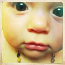 hierarchy of intervention