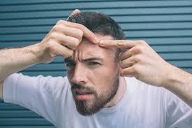 Acne is a condition where oils glands of the skin become clogged, forming spots, pimples, and sometimes cysts. Does Excessive Masturbation Cause Acne Or Has Any Effect On The Skin Sexual Health Medical Answers Family Health Center Steadyhealth Com