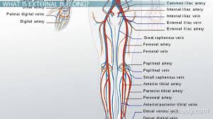 external bleeding definition types