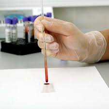 ● ce remedii exista anti herpes? Intrebari Frecvente Despre Herpesul Genital Medlife