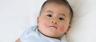 We did not find results for: Babyakne Ursache Behandlung Und Tipps Gegen Akne Pampers