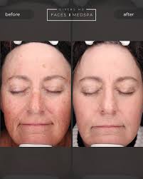 Faces Medspa and Givens MD Facial Plastic Surgery