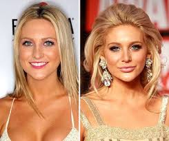 Celebrity Plastic Surgery Photos
