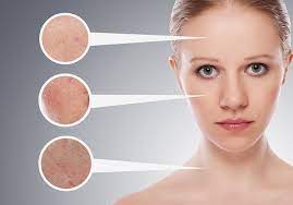 Women tend to utilize the process to get rid of unsightly facial hair and removing hair from the leg and bikini line. What Are The Real Side Effects Of Electrolysis Hair Free Life