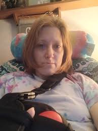 Bariatric surgery recovery and walking experience