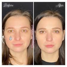 Megan Winter PA-C (@meganc_aesthetics) • Instagram photos and videos