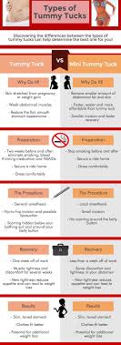 Tummy Tuck Mini Tummy Tuck Tummy Tuck Surgery Mommy Makeover