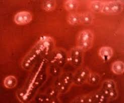 Testarea antigenului streptococului beta hemolitic de grup a are utilitate scăzută în practica medicală; Streptococ Beta Hemolitic Grup B