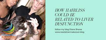 This can result in chronic inflammation and liver damage. How Hair Loss Can Be Related To Liver Dysfunction By Diane Shawe All About On Demand Courses Hair Extensions And Franchise Opportunity By Diane Shawe