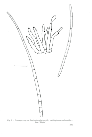 Image result for Leptactina platyphylla