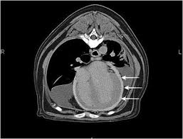 Check spelling or type a new query. Cardiovascular Images Constrictive Pericarditis And Tricavitary Effusion In A Dog With Pericardial Mesothelioma Sciencedirect