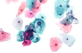 Check spelling or type a new query. Papanicolaou Stain Wikipedia